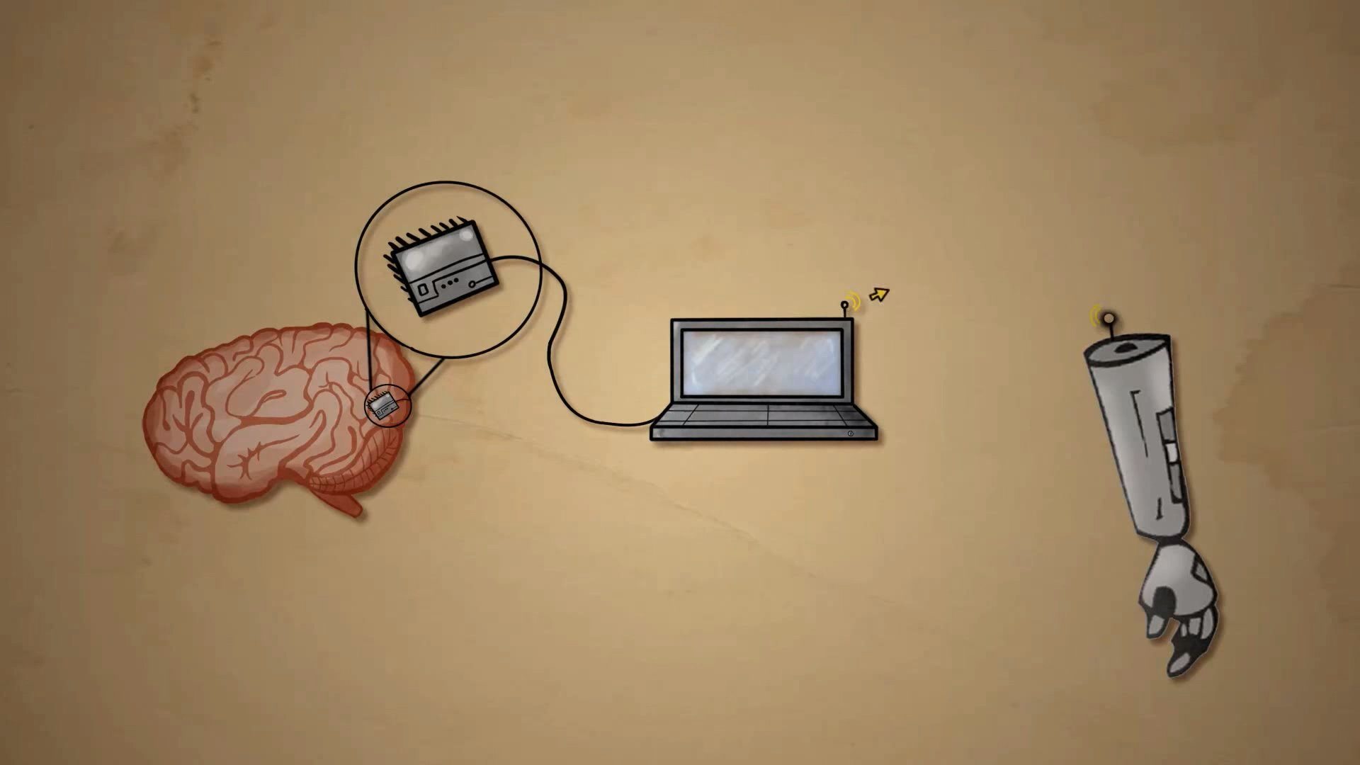 Brain Computers