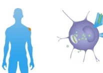 Cancer Vaccine