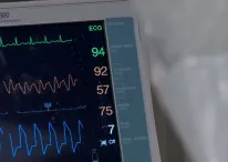 ECMO