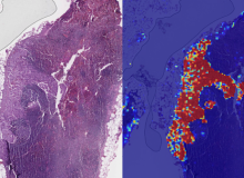 Google Ai Can Now Spot Breast Cancer Better Than Humans 3 Google Ai Can Now Spot Breast Cancer Better Than Humans