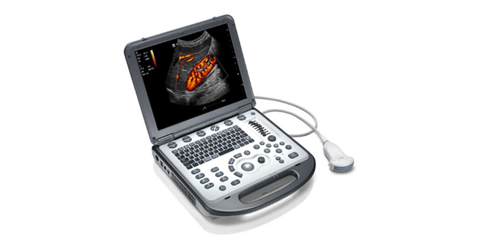 A Portable Ultrasound Machine